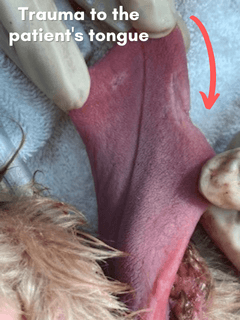 damage to tongue